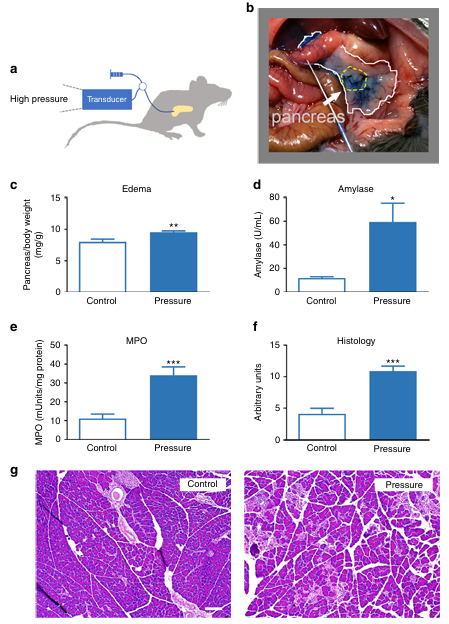 Piezo1是一種介導(dǎo)壓力誘導(dǎo)胰腺炎的機(jī)械激活離子通道